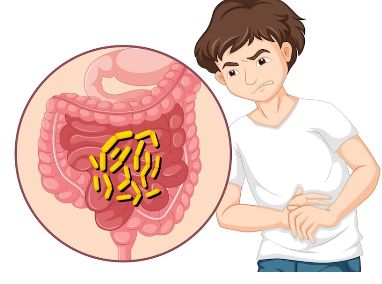 Signs Your Body is Fighting a Bacterial Infection